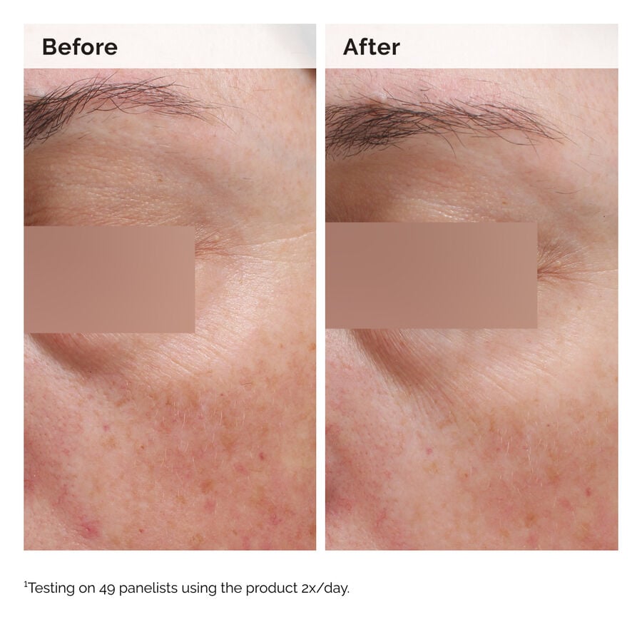 niacinamide-5-face-and-body-emulsion-f6 2024-08-23-ORD-Nia-5pct-Face-Body-B-A-Elasticity-Global-02-1x1.jpg