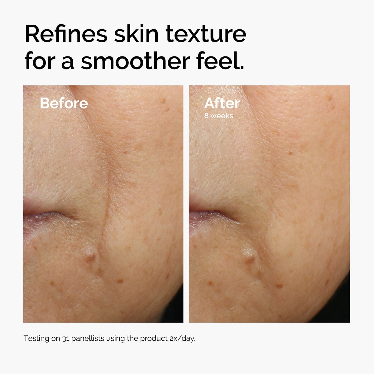 caffeine-3-escin-1-face-serum-o0 ord-caffeine-3pct-escin-1pct-face-serum-before-after-texture.jpg