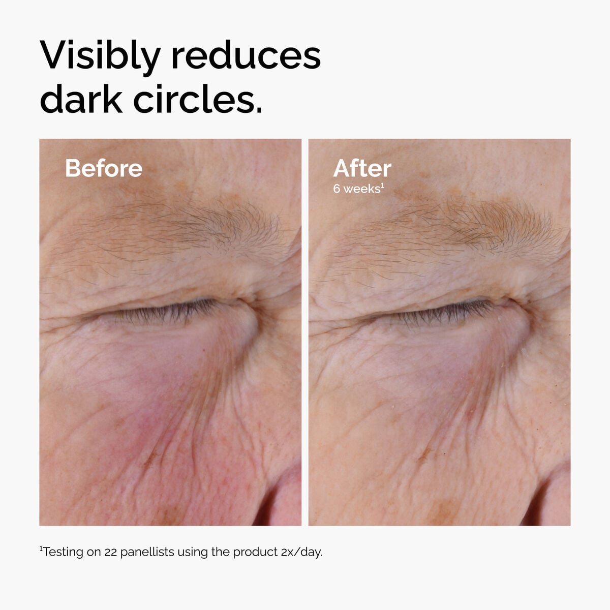 caffeine-solution-5-egcg-eye-serum-s9 ord-caffeine-solution-egcg-dark-circles-before-after.jpg