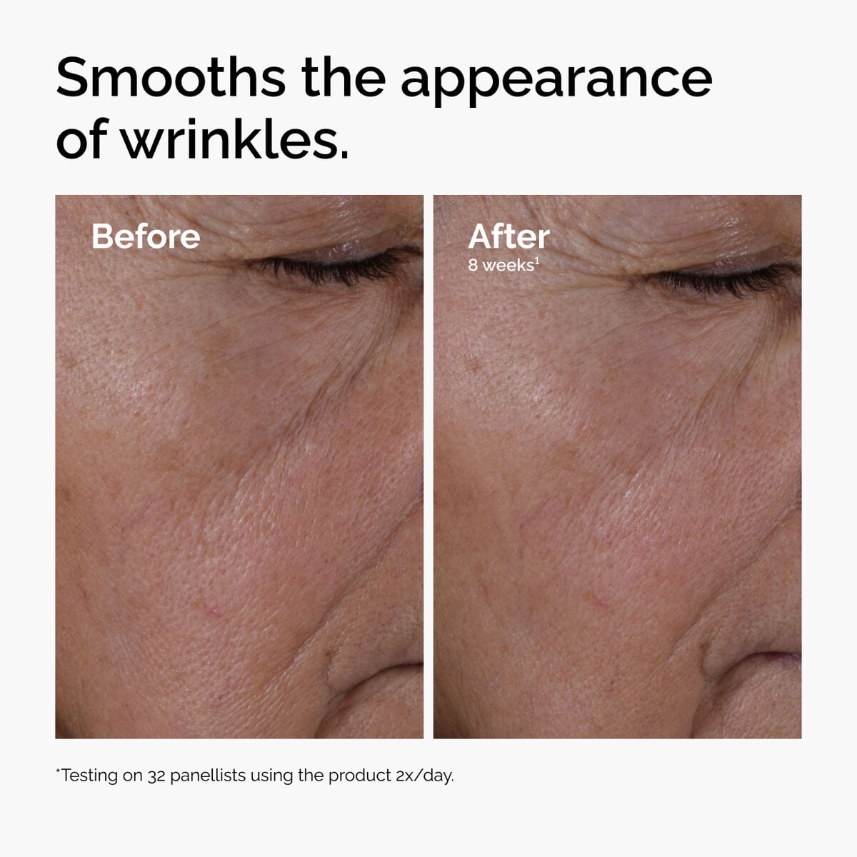 multi-peptide-ha-serum-u9 ord-multi-peptide-ha-serum-wrinkles-before-after.jpg